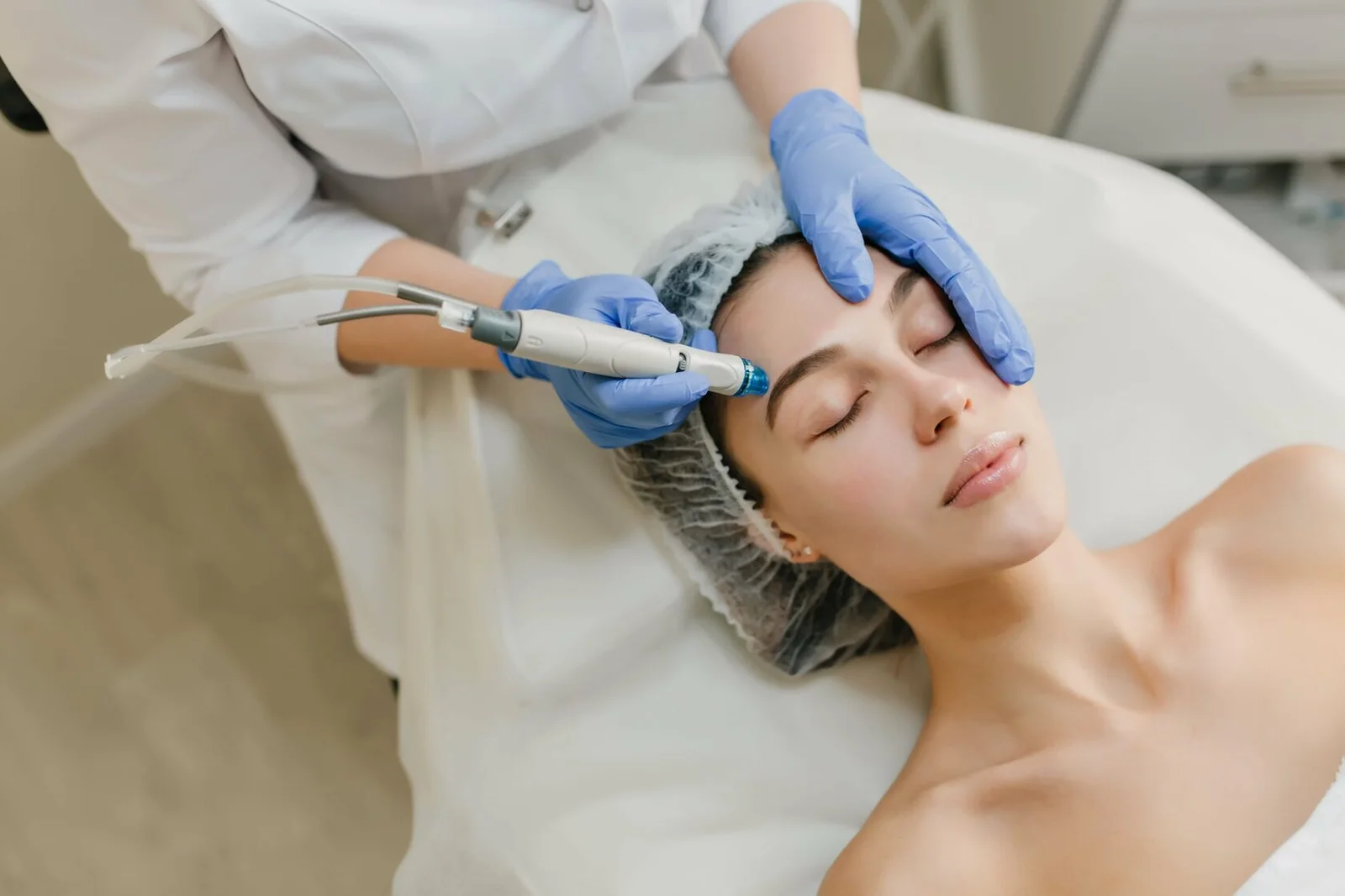 Dermapen + peeling químico