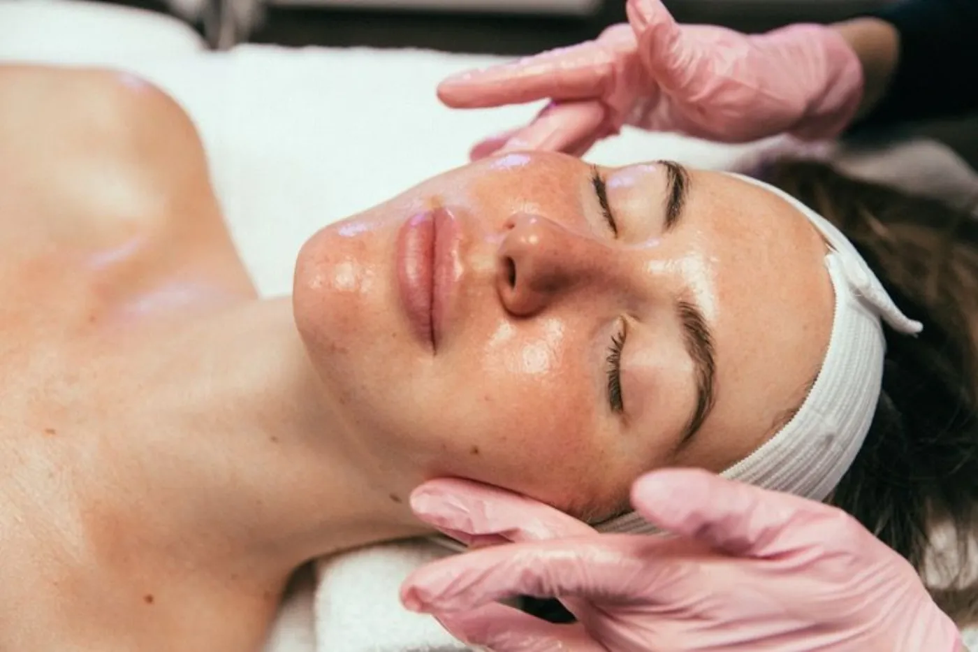 Peeling Melanostop Tranex + higiene profunda