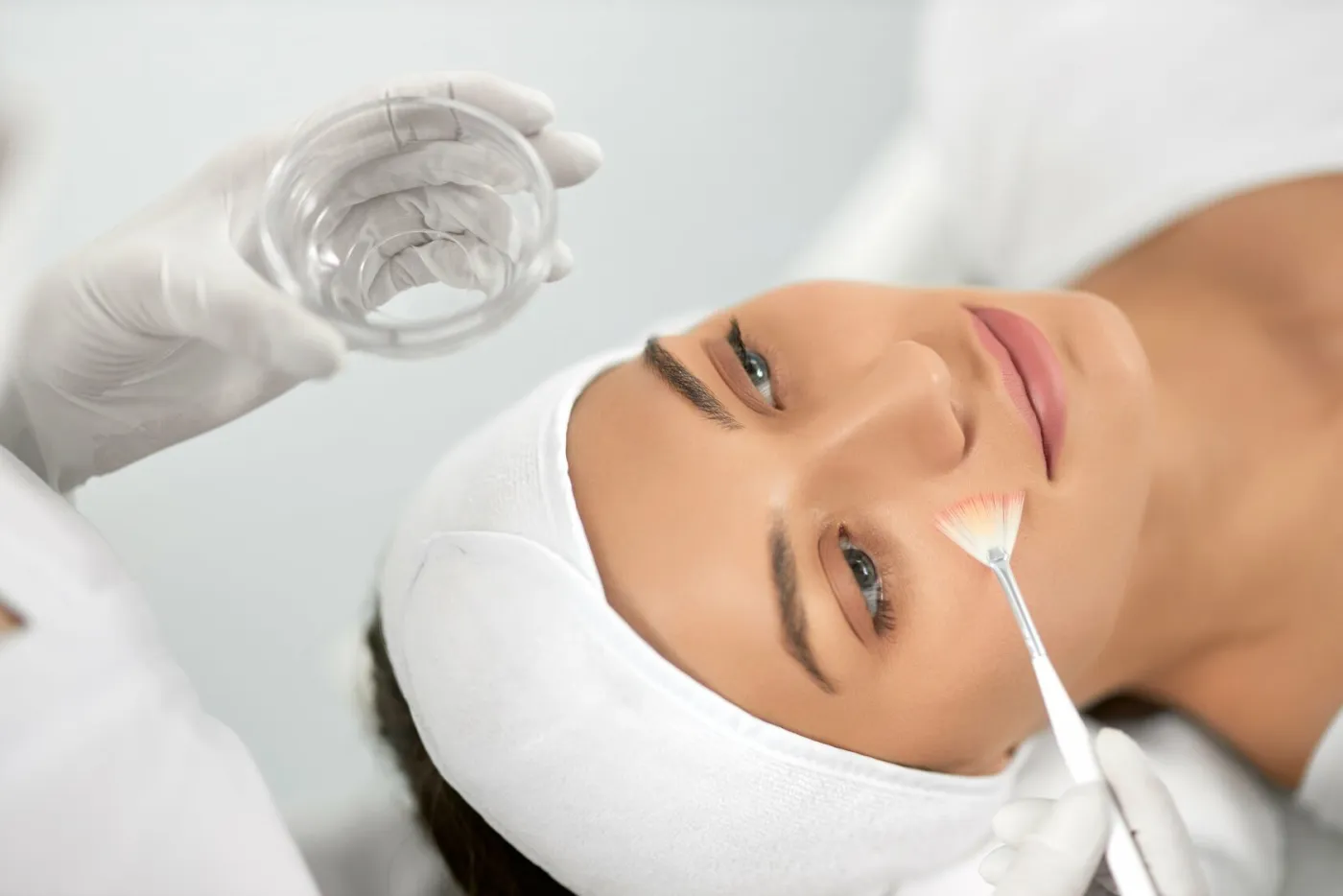 Peeling azelaico 20%