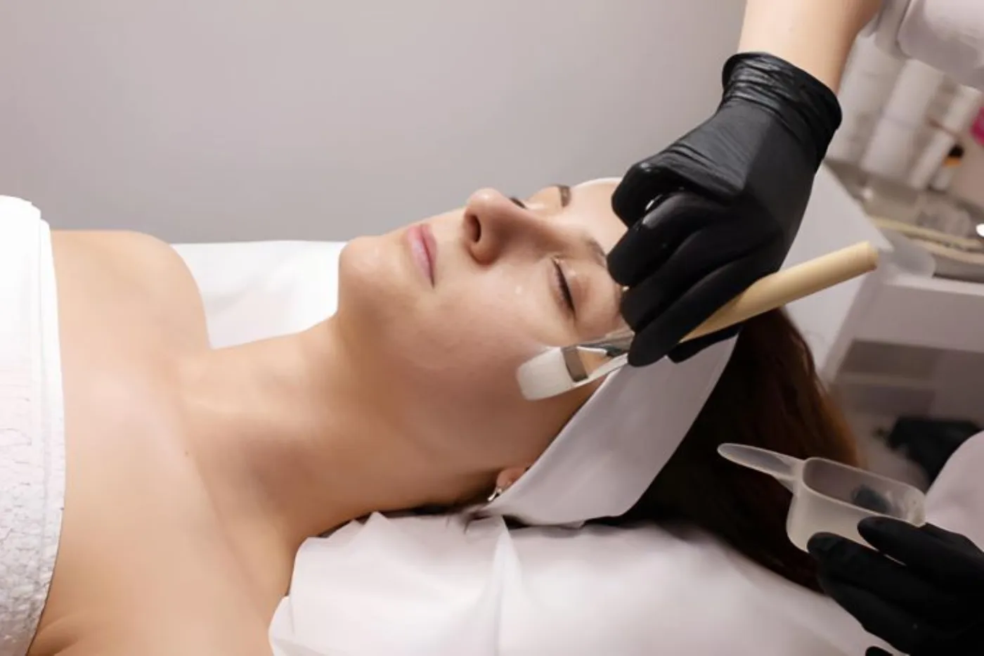 Peeling Retises CT Yellow Peel + higiene profunda