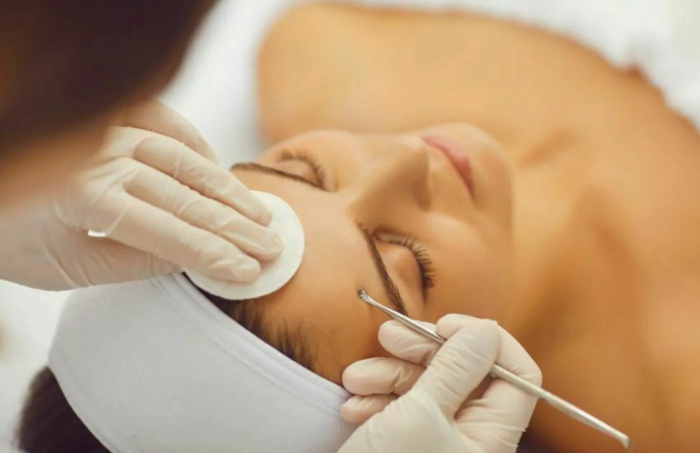 Higiene sanitaria profunda + peeling láctico 40%
