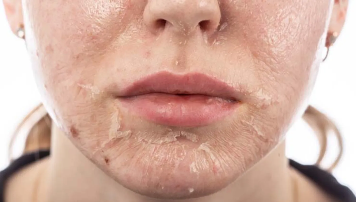 Peeling natural orgánico